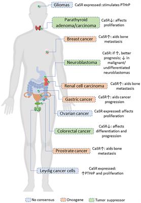 The CaSR in Pathogenesis of Breast Cancer: A New Target for Early Stage Bone Metastases